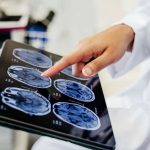 5 Nurses In The Same Maternity Ward All Have Brain Tumors?